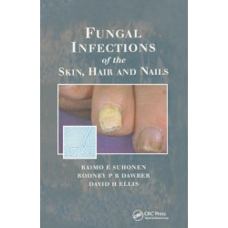 Fungal Infections of the Skin and Nails