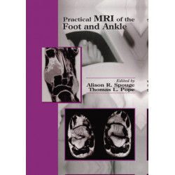 Practical MRI of the Foot and Ankle