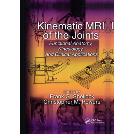 Kinematic MRI of the Joints: Functional Anatomy, Kinesiology, and Clinical Applications