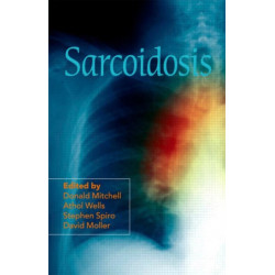Sarcoidosis