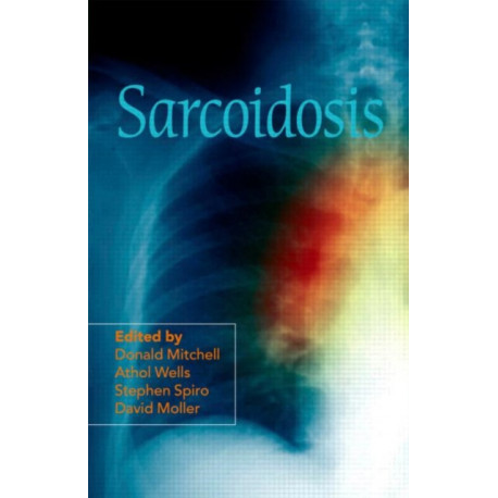 Sarcoidosis