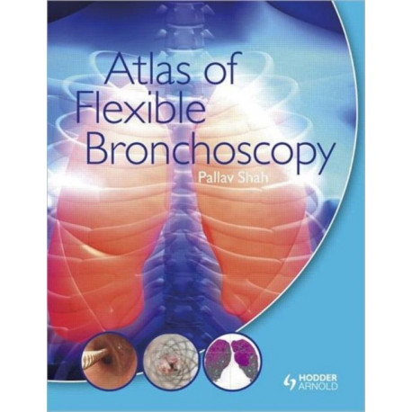 Atlas of Flexible Bronchoscopy