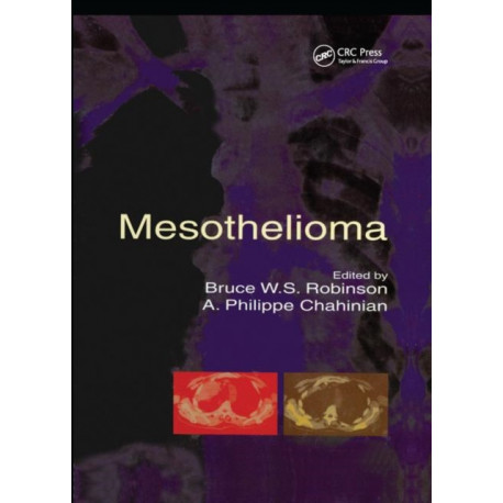 Mesothelioma