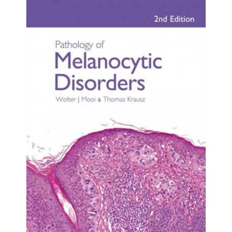 Pathology of Melanocytic Disorders 2ed