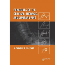 Fractures of the Cervical, Thoracic, and Lumbar Spine