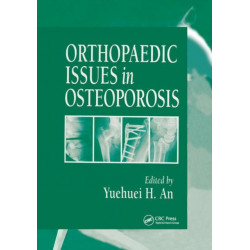 Orthopaedic Issues in Osteoporosis