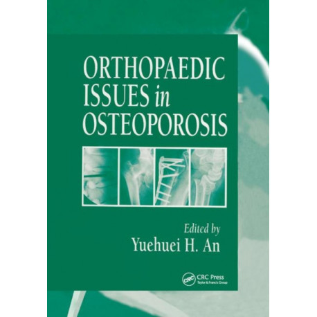Orthopaedic Issues in Osteoporosis