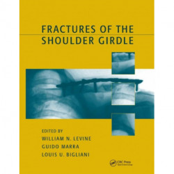 Fractures of the Shoulder Girdle