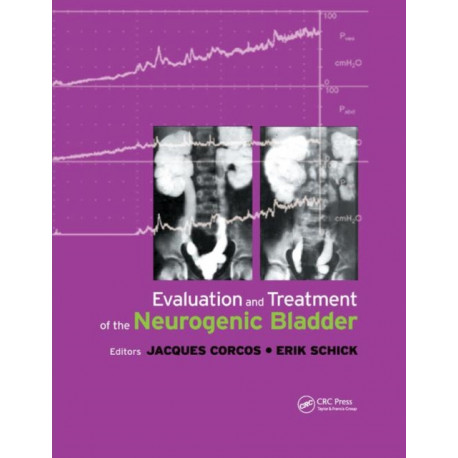 Evaluation and Treatment of the Neurogenic Bladder