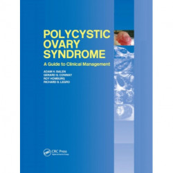 Polycystic Ovary Syndrome: A Guide to Clinical Management