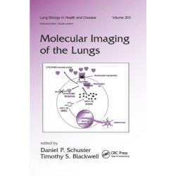 Molecular Imaging of the Lungs