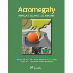Acromegaly: Pathology, Diagnosis and Treatment