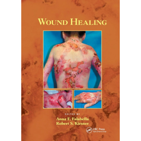 Wound Healing