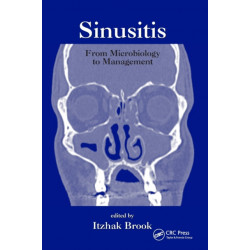 Sinusitis: From Microbiology To Management
