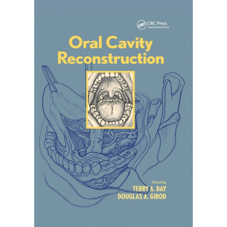 Oral Cavity Reconstruction
