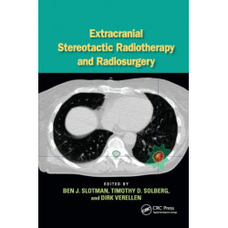 Extracranial Stereotactic Radiotherapy and Radiosurgery
