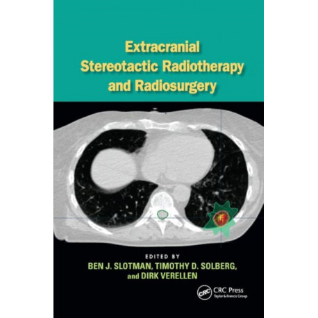 Extracranial Stereotactic Radiotherapy and Radiosurgery