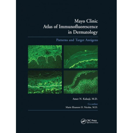 Mayo Clinic Atlas of Immunofluorescence in Dermatology: Patterns and Target Antigens