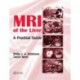 MRI of the Liver: A Practical Guide