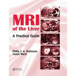 MRI of the Liver: A Practical Guide