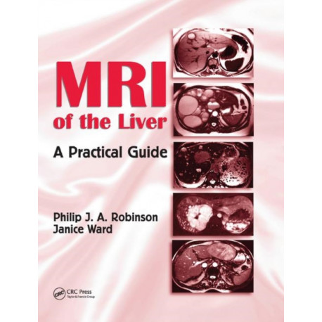 MRI of the Liver: A Practical Guide