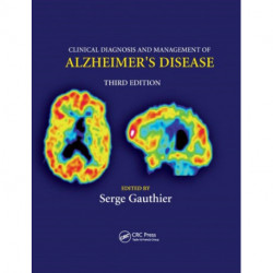 Clinical Diagnosis and Management of Alzheimer's Disease