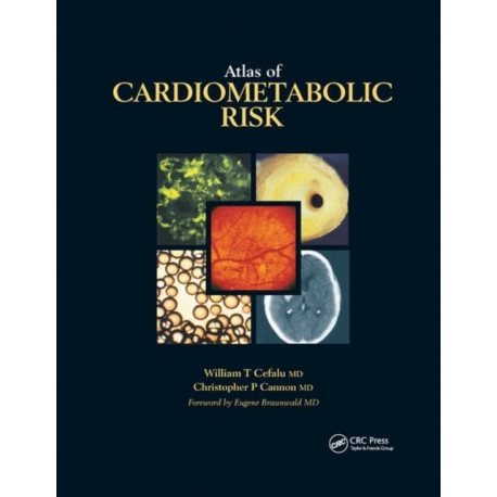 Atlas of Cardiometabolic Risk