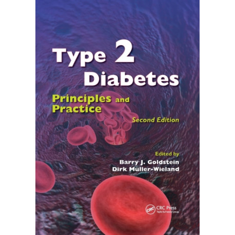 Type 2 Diabetes: Principles and Practice, Second Edition