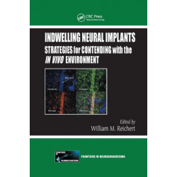 Indwelling Neural Implants: Strategies for Contending with the In Vivo Environment