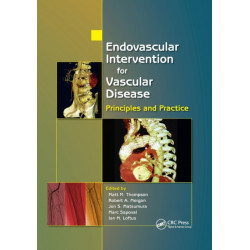 Endovascular Intervention for Vascular Disease: Principles and Practice
