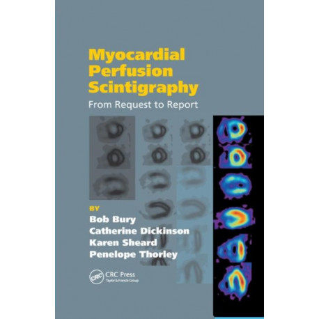 Myocardial Perfusion Scintigraphy: From Request to Report