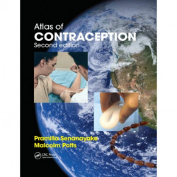 Atlas of Contraception