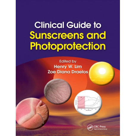 Clinical Guide to Sunscreens and Photoprotection