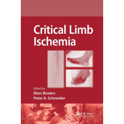 Critical Limb Ischemia
