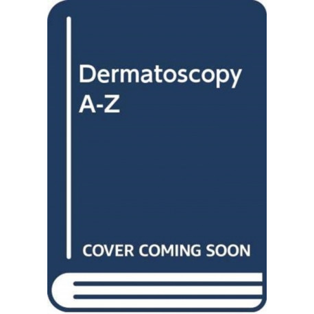 Dermatoscopy A-Z