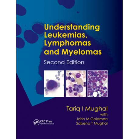 Understanding Leukemias, Lymphomas and Myelomas