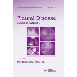 Pleural Disease
