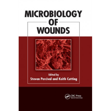 Microbiology of Wounds