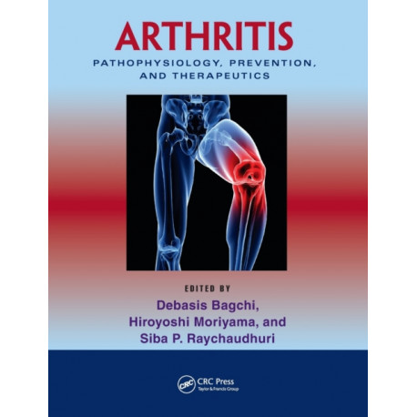 Arthritis: Pathophysiology, Prevention, and Therapeutics