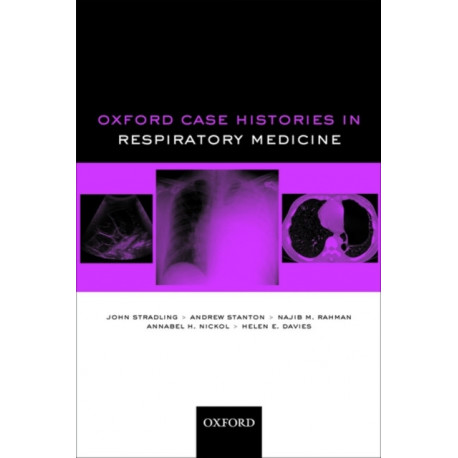 Oxford Case Histories in Respiratory Medicine