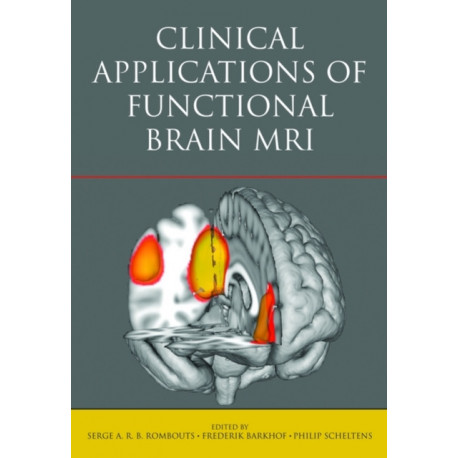 Clinical Applications of Functional Brain MRI
