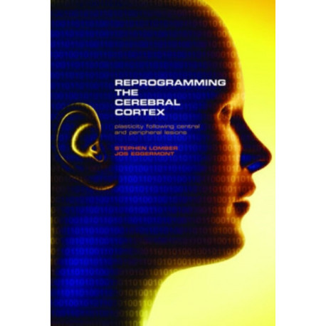 Reprogramming the Cerebral Cortex: Plasticity following central and peripheral lesions