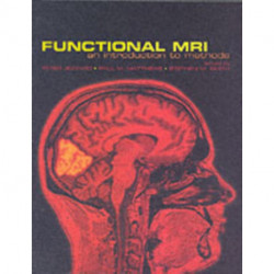 Functional Magnetic Resonance Imaging: An Introduction to Methods