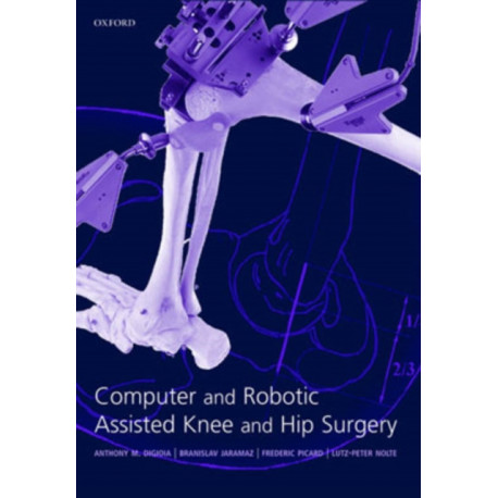 Computer and Robotic Assisted Hip and Knee Surgery