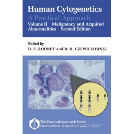 Human Cytogenetics: A Practical Approach: Volume II: Malignancy and Acquired Abnormalities