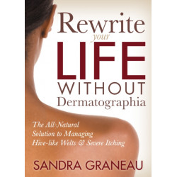 Rewrite Your Life Without Dermatographia: The All-Natural Solution to Managing Hive-like Welts and Severe Itching