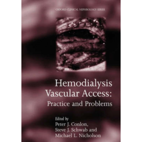 Hemodialysis Vascular Access: Practice and problems