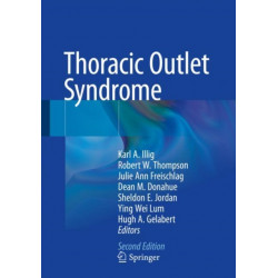 Thoracic Outlet Syndrome
