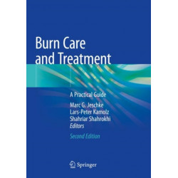 Burn Care and Treatment: A Practical Guide
