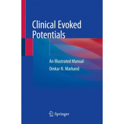 Clinical Evoked Potentials: An Illustrated Manual